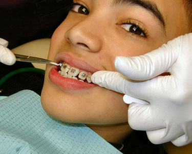 Kids Ocala: Orthodontists - Fun 4 Ocala Kids